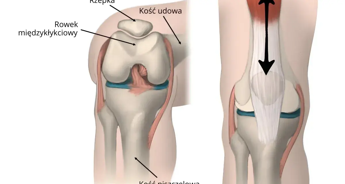 Anatomia stawu rzepkowo udowego: rzepka, kość udowa, rowek międzykłykciowy i kość piszczelowa. Strzałki pokazują ruch.