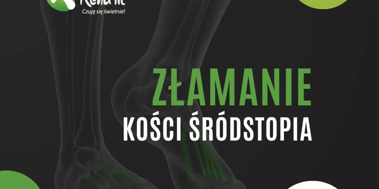 Bezpieczne ćwiczenia po złamaniu śródstopia od gipsu do biegania