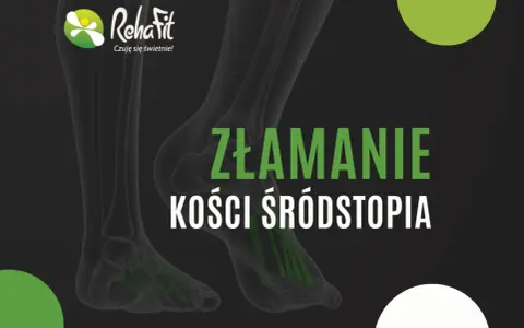 Bezpieczne ćwiczenia po złamaniu śródstopia od gipsu do biegania