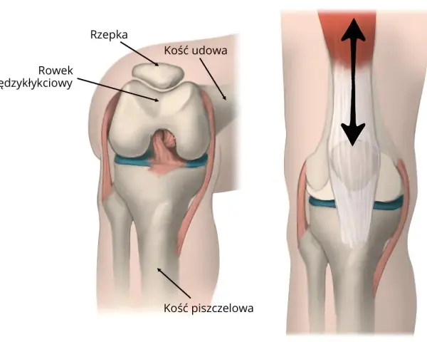 Anatomia stawu rzepkowo udowego: rzepka, kość udowa, rowek międzykłykciowy i kość piszczelowa. Strzałki pokazują ruch.