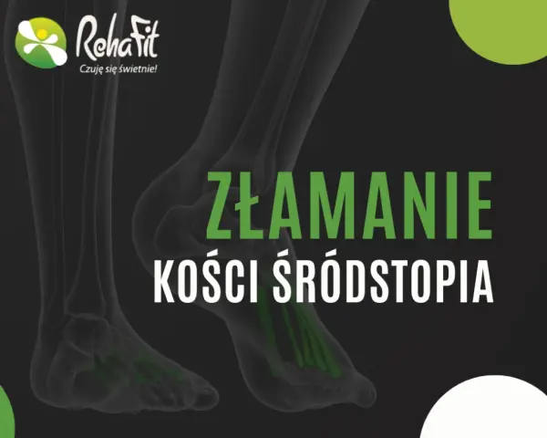 Bezpieczne ćwiczenia po złamaniu śródstopia od gipsu do biegania