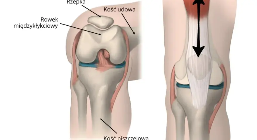Anatomia stawu rzepkowo udowego: rzepka, kość udowa, rowek międzykłykciowy i kość piszczelowa. Strzałki pokazują ruch.
