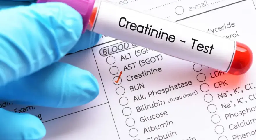 Ręka w niebieskiej rękawiczce trzyma probówkę z napisem "Creatinine - Test". Zaznaczono opcję "Creatinine" na formularzu badań.