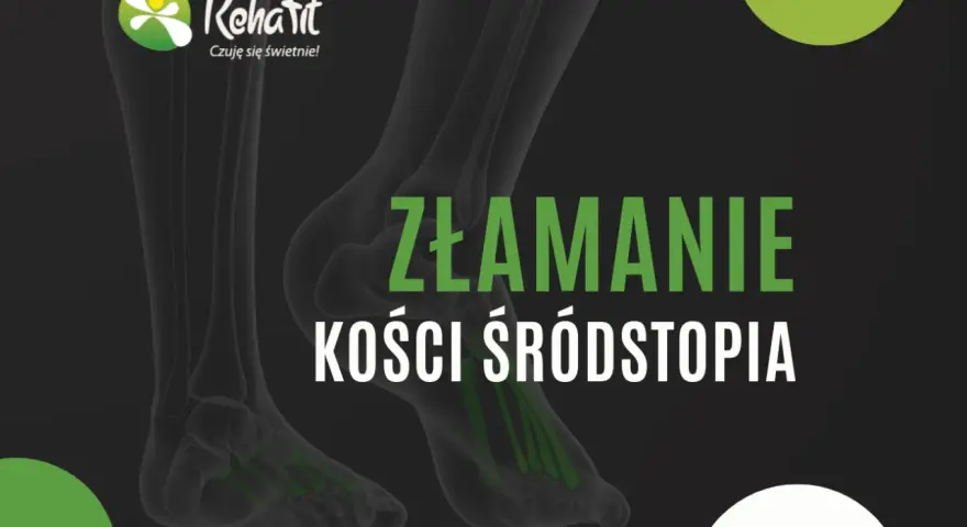 Bezpieczne ćwiczenia po złamaniu śródstopia od gipsu do biegania