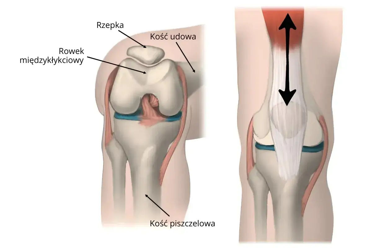 Anatomia stawu rzepkowo udowego: rzepka, kość udowa, rowek międzykłykciowy i kość piszczelowa. Strzałki pokazują ruch.